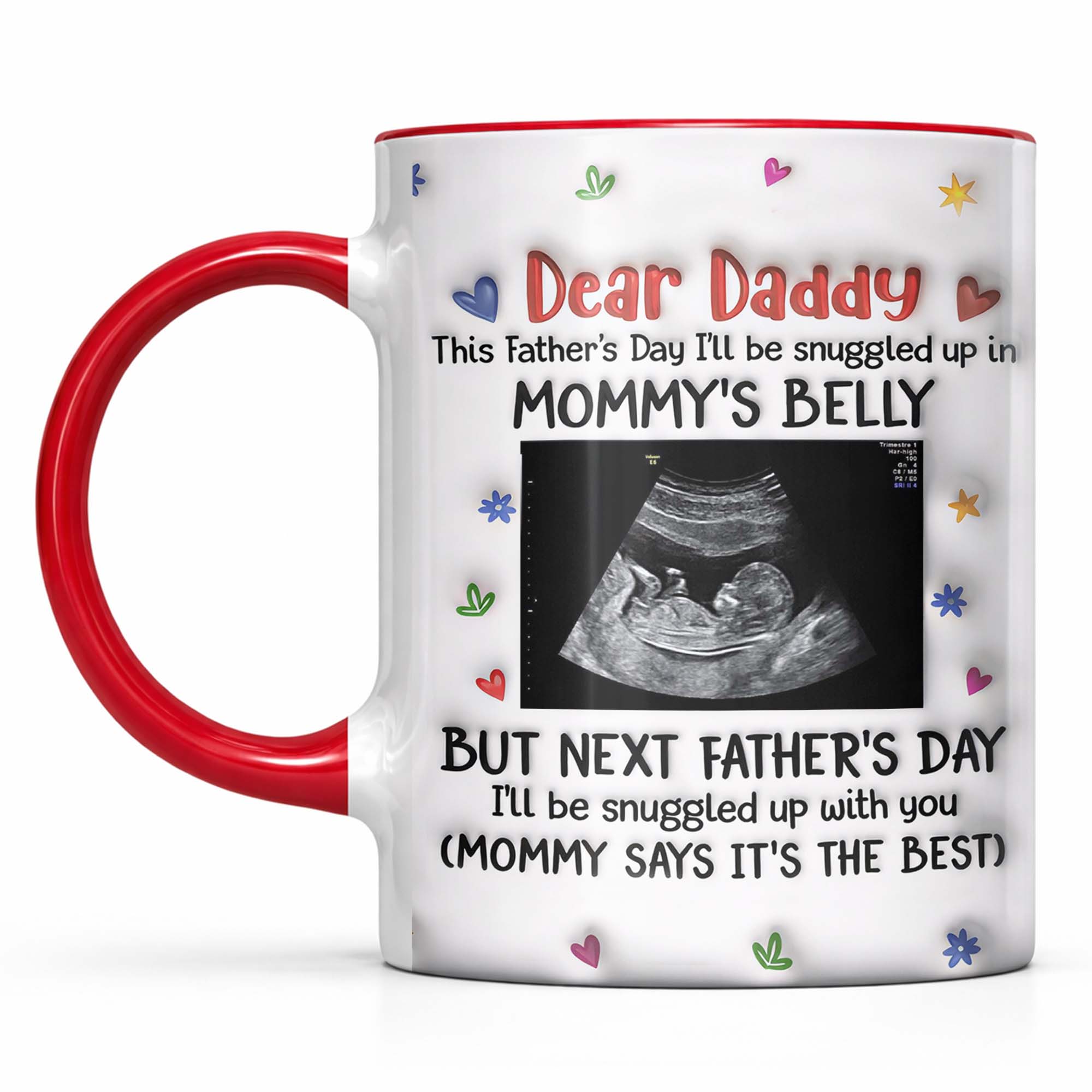 Personalized Accent Mug Custom Ultrasound Photo Gift for Dad