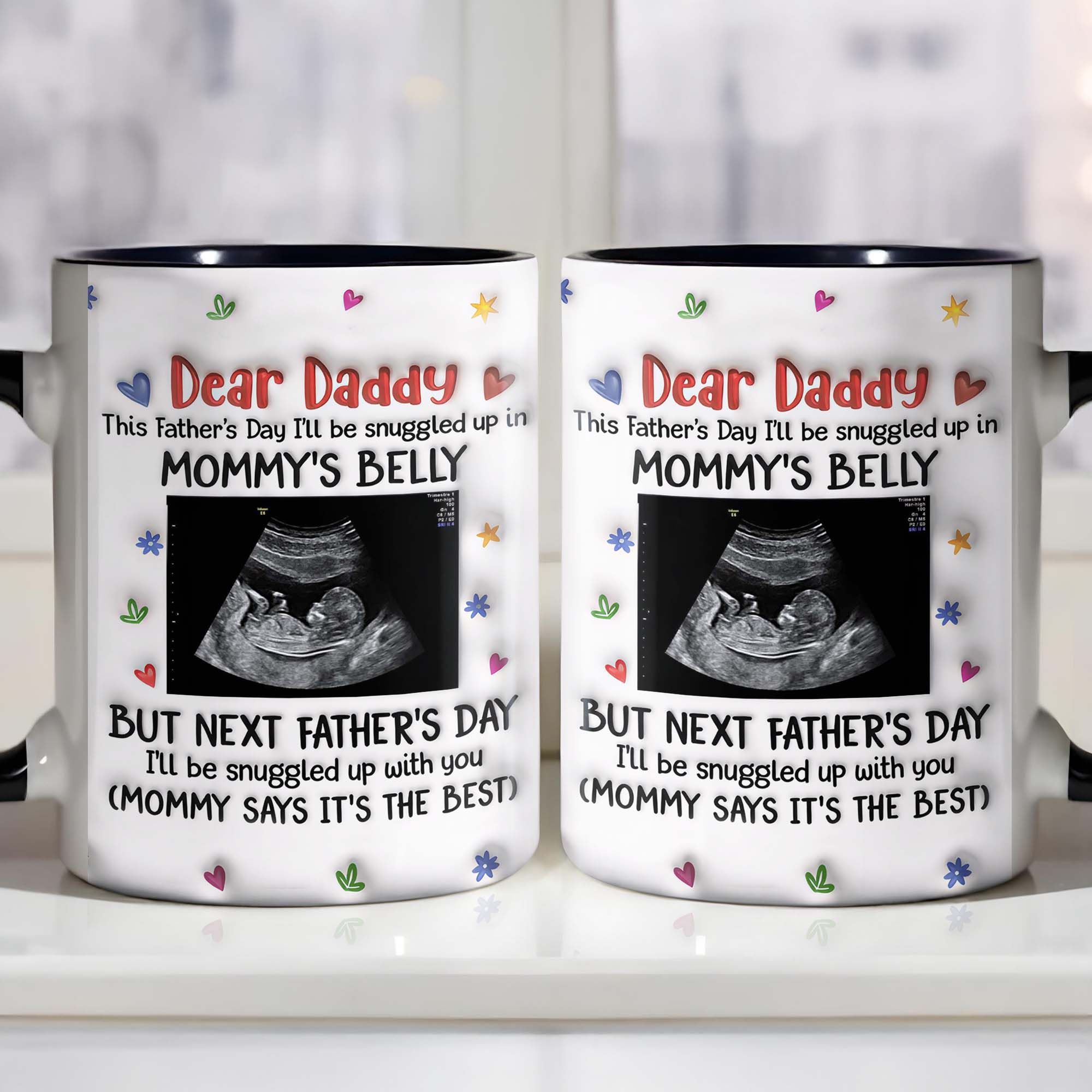 Personalized Accent Mug Custom Ultrasound Photo Gift for Dad