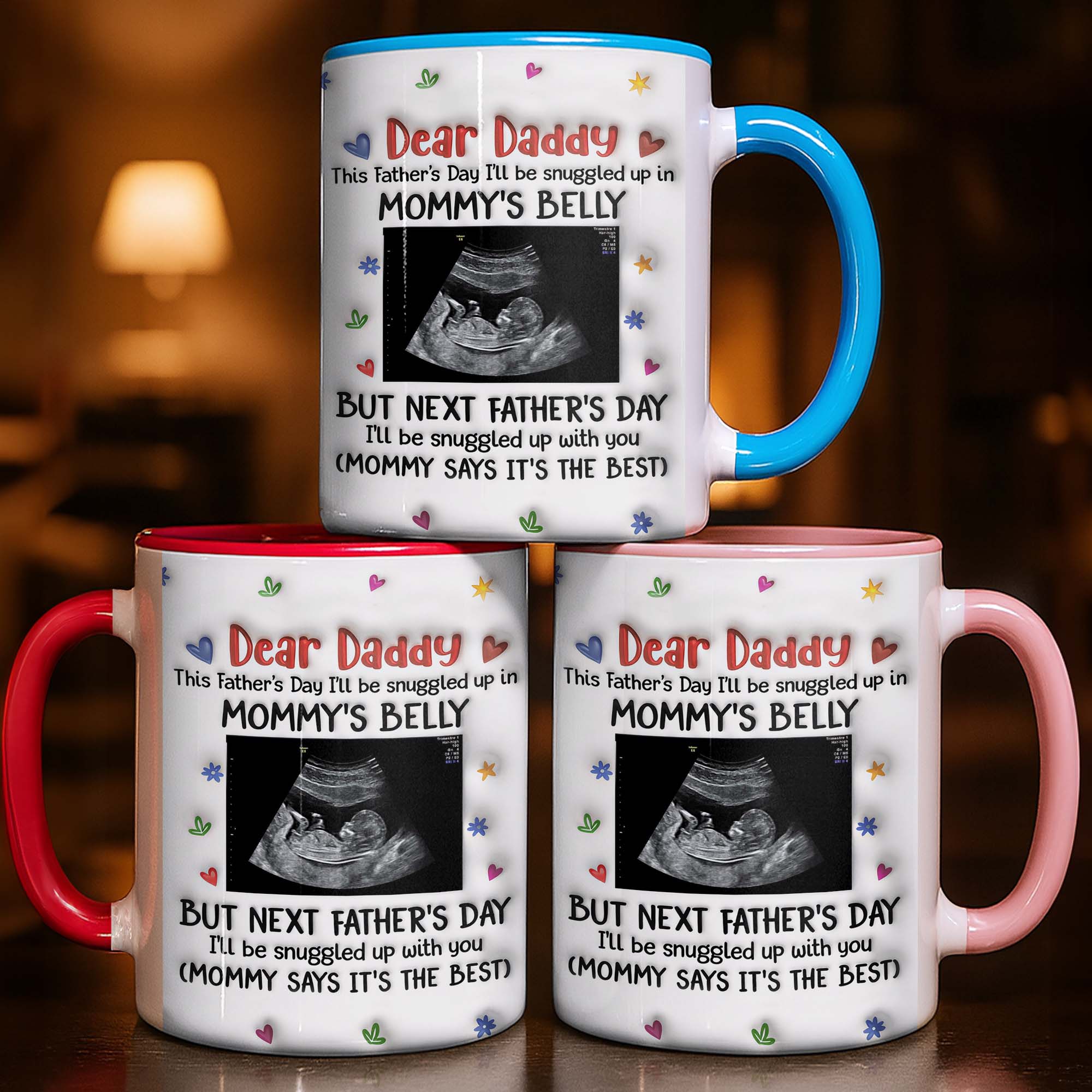 Personalized Accent Mug Custom Ultrasound Photo Gift for Dad