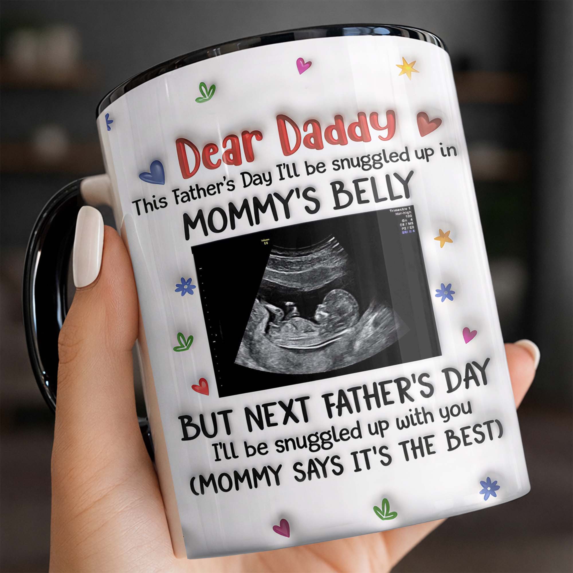 Personalized Accent Mug Custom Ultrasound Photo Gift for Dad