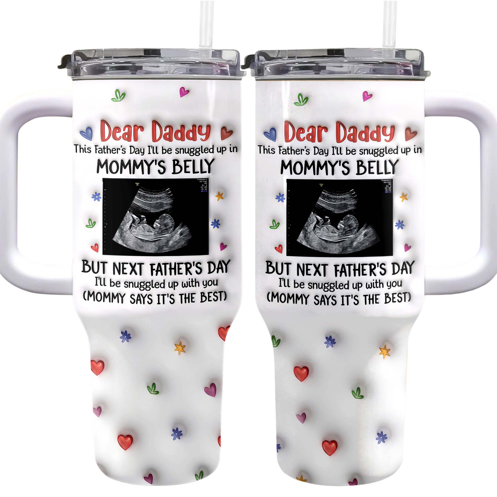 Personalized 40oz Tumbler for Dad with Ultrasound Design Gift