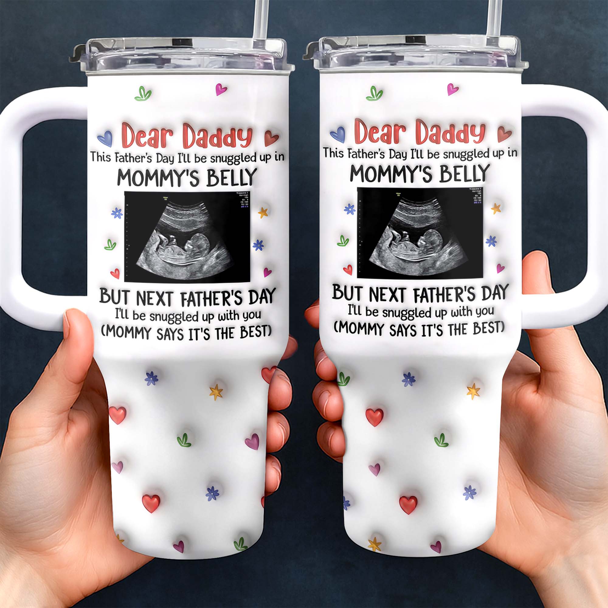 Personalized 40oz Tumbler for Dad with Ultrasound Design Gift