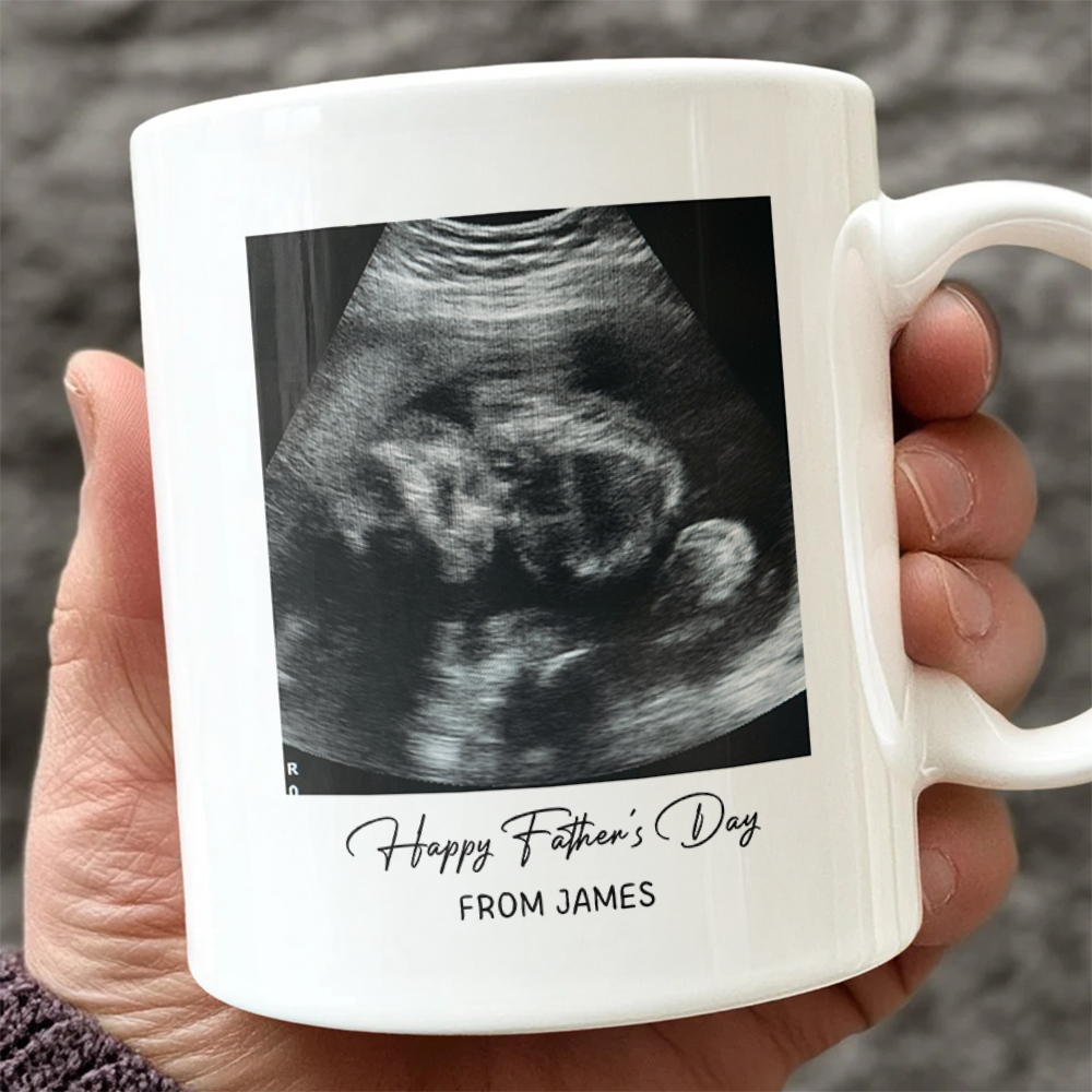 Personalized Photo Mug Custom Baby Scan Gift for Father's Day