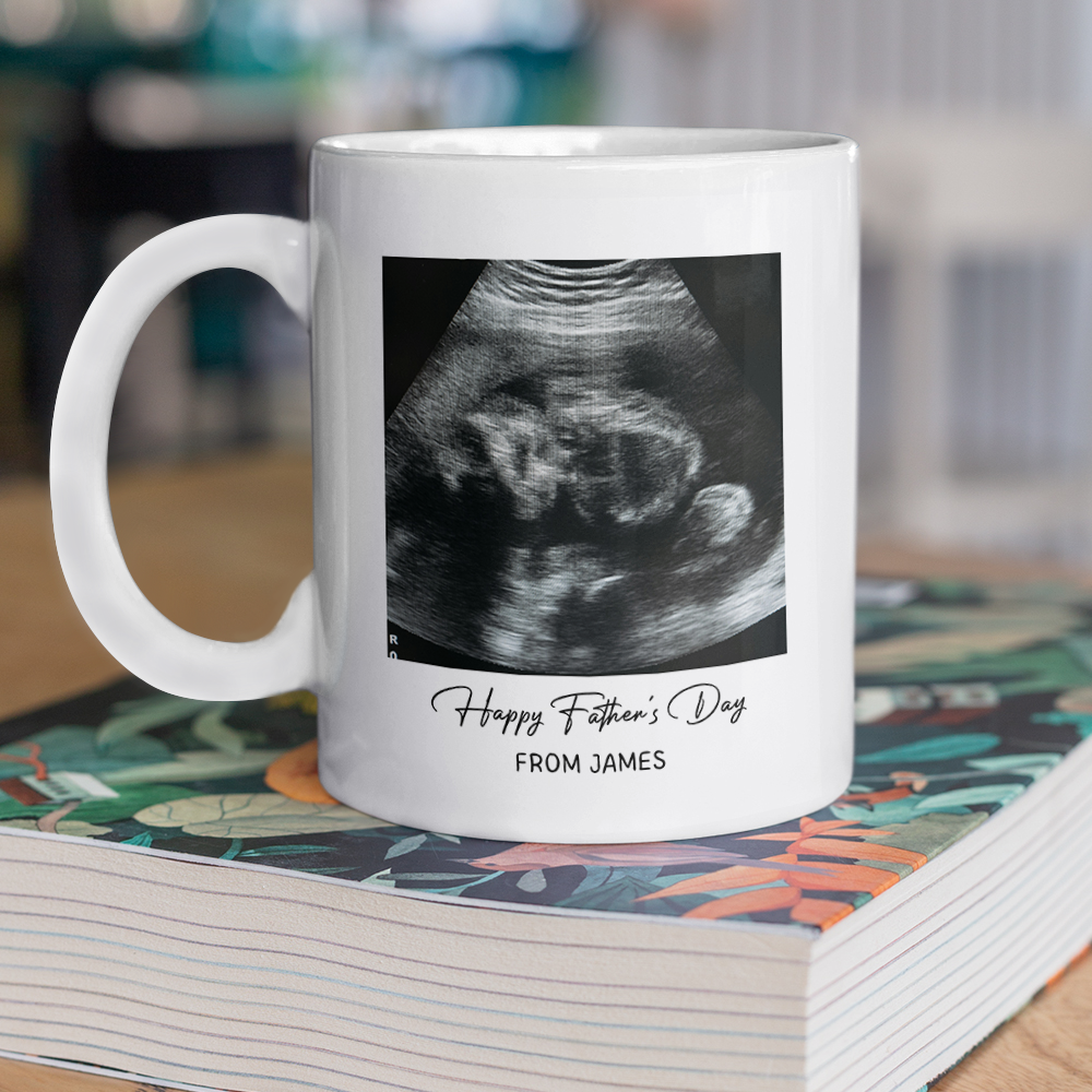 Personalized Photo Mug Custom Baby Scan Gift for Father's Day