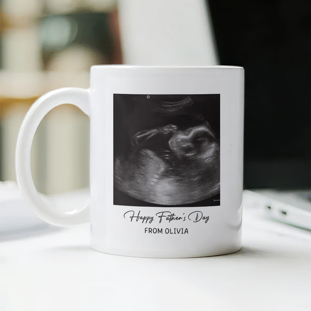 Personalized Photo Mug Custom Baby Scan Gift for Father's Day